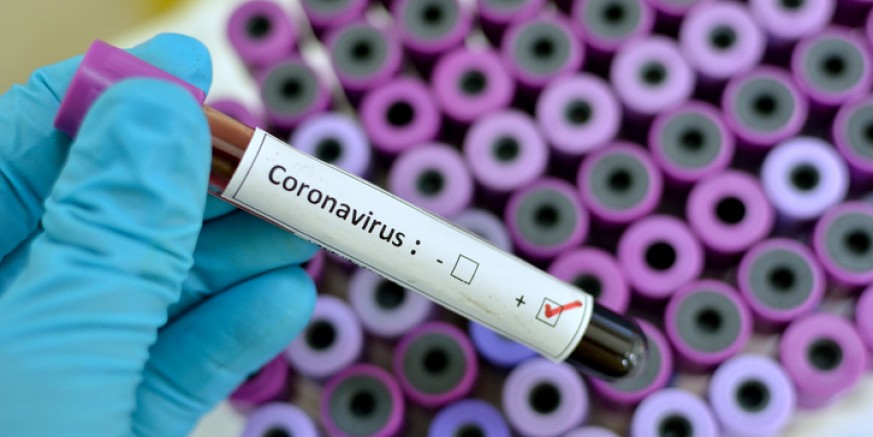 Odluka o provođenju mjera zaštite od korona virusa na području Varaždinske županije
